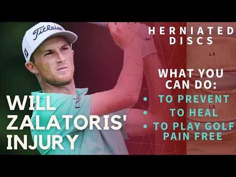 II. Umbilical Hernia