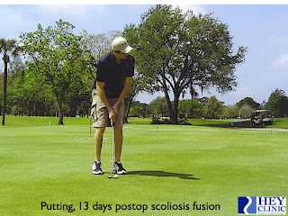 Consulting Your Doctor: When Can You Return to Sports?